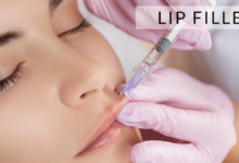 lip fillers near me